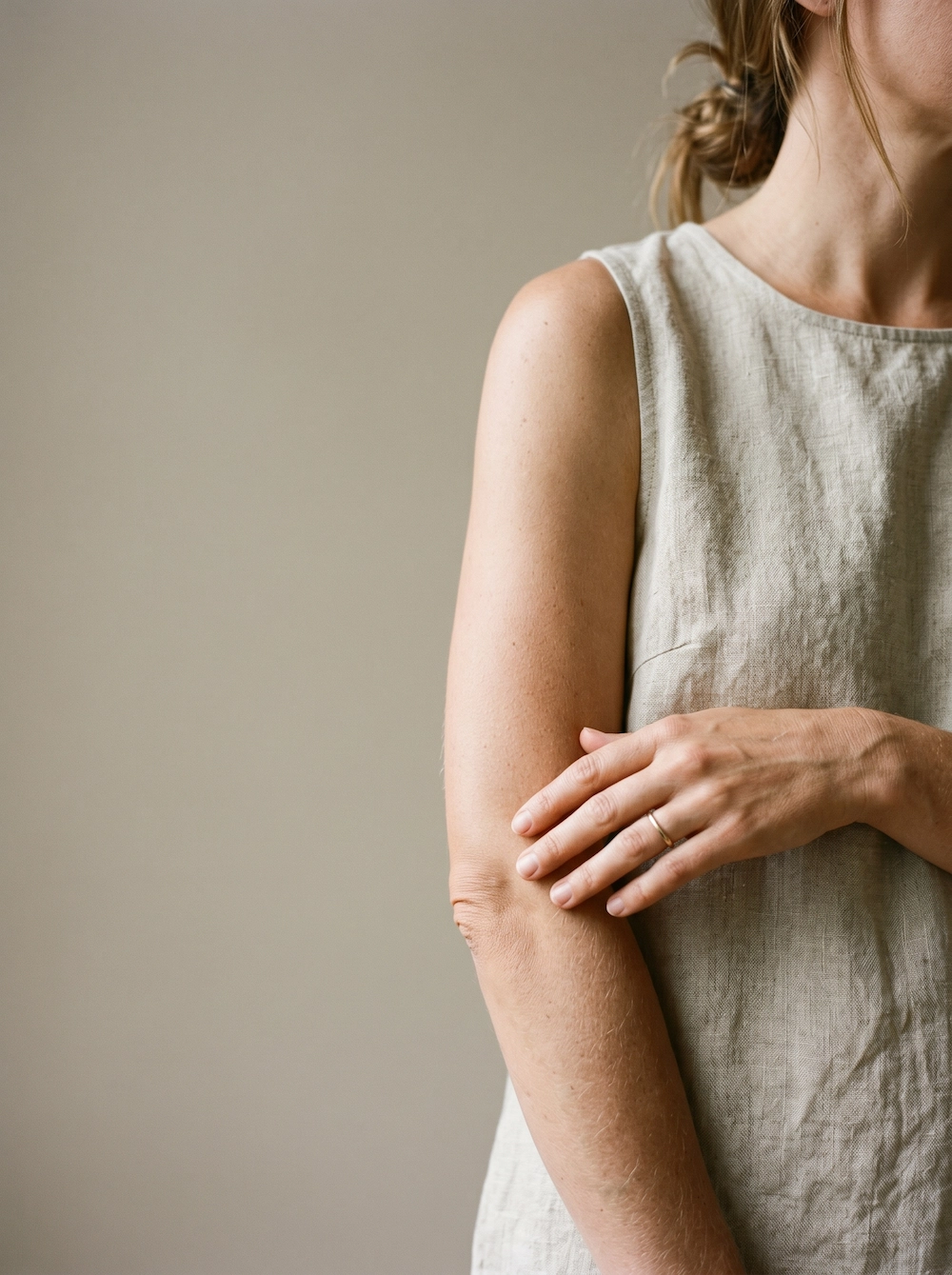 Arm lift result, upper arm contour restored
