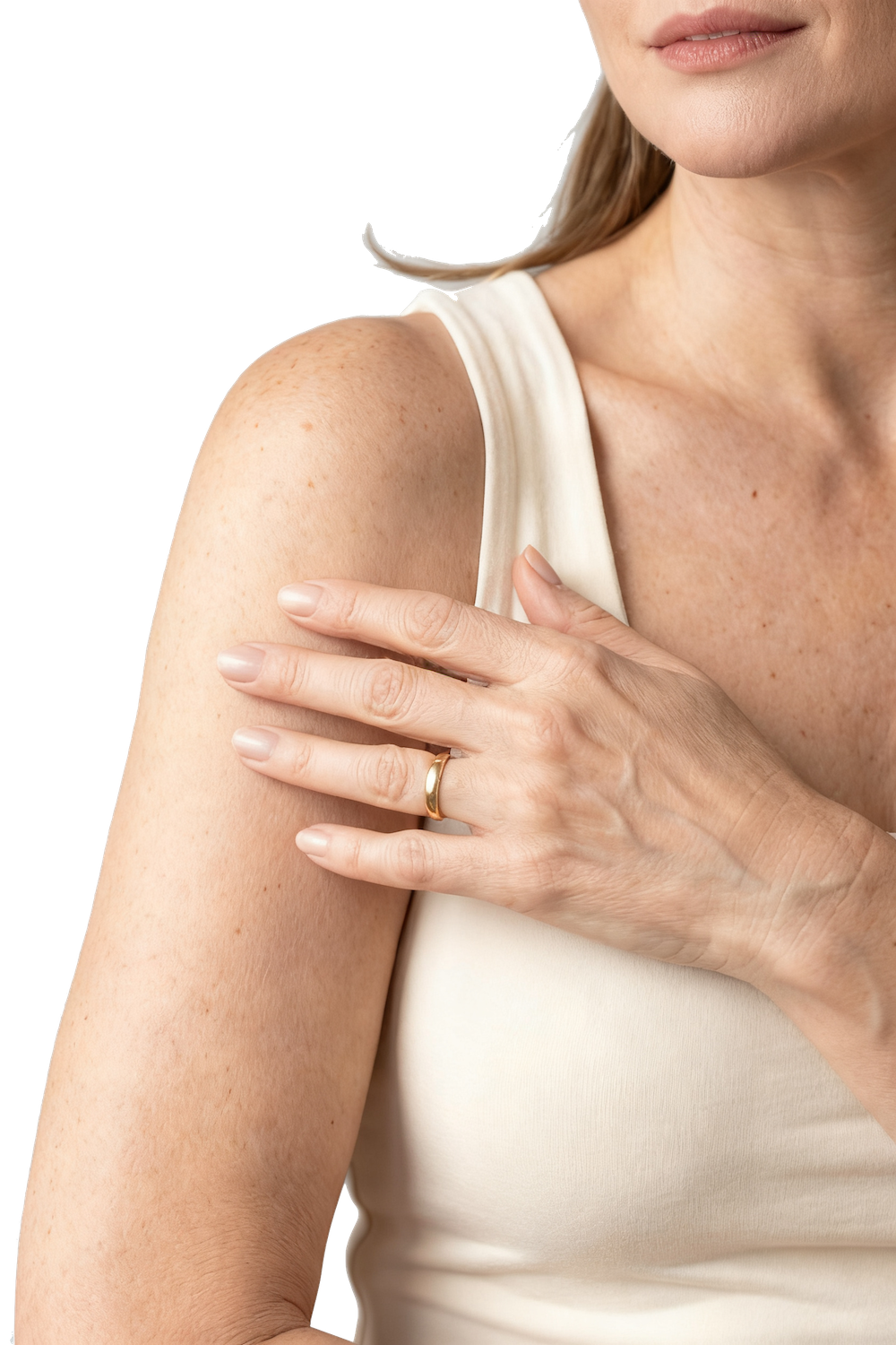 Arm lift brachioplasty in Bluffton SC